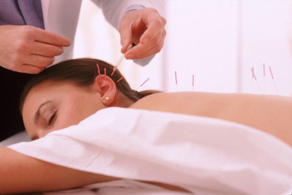 Acupuntura e acupuntura com osteocondrose cervical