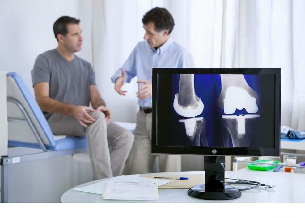 Artrose da articulação do joelho na imagem X -Ray